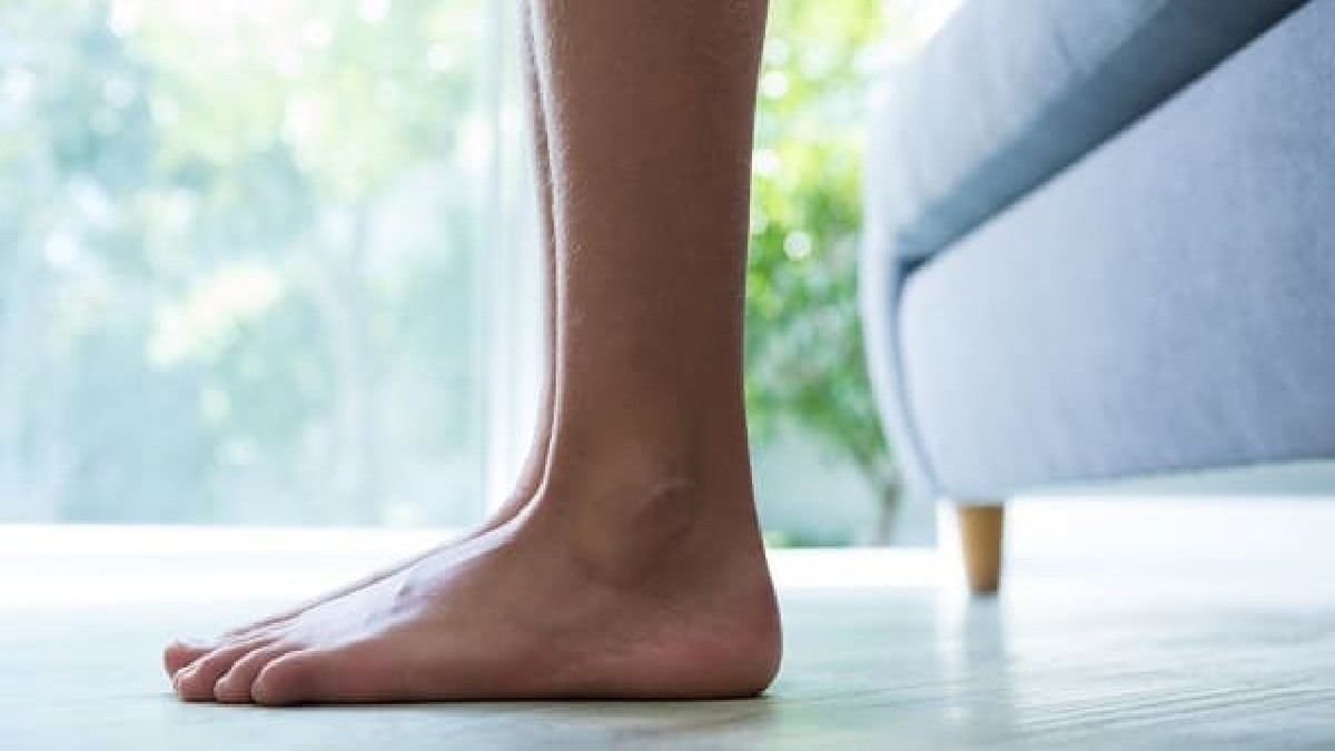 عارضه کف پای صاف بیشتر در چه سنینی دیده می‌شود؟ + فیلم