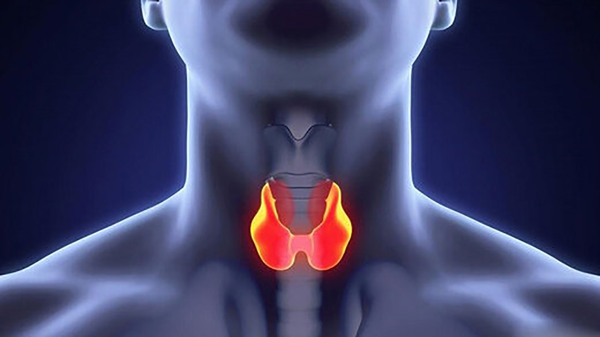 راه حل رفع تیرگی زیر چشم + فیلم