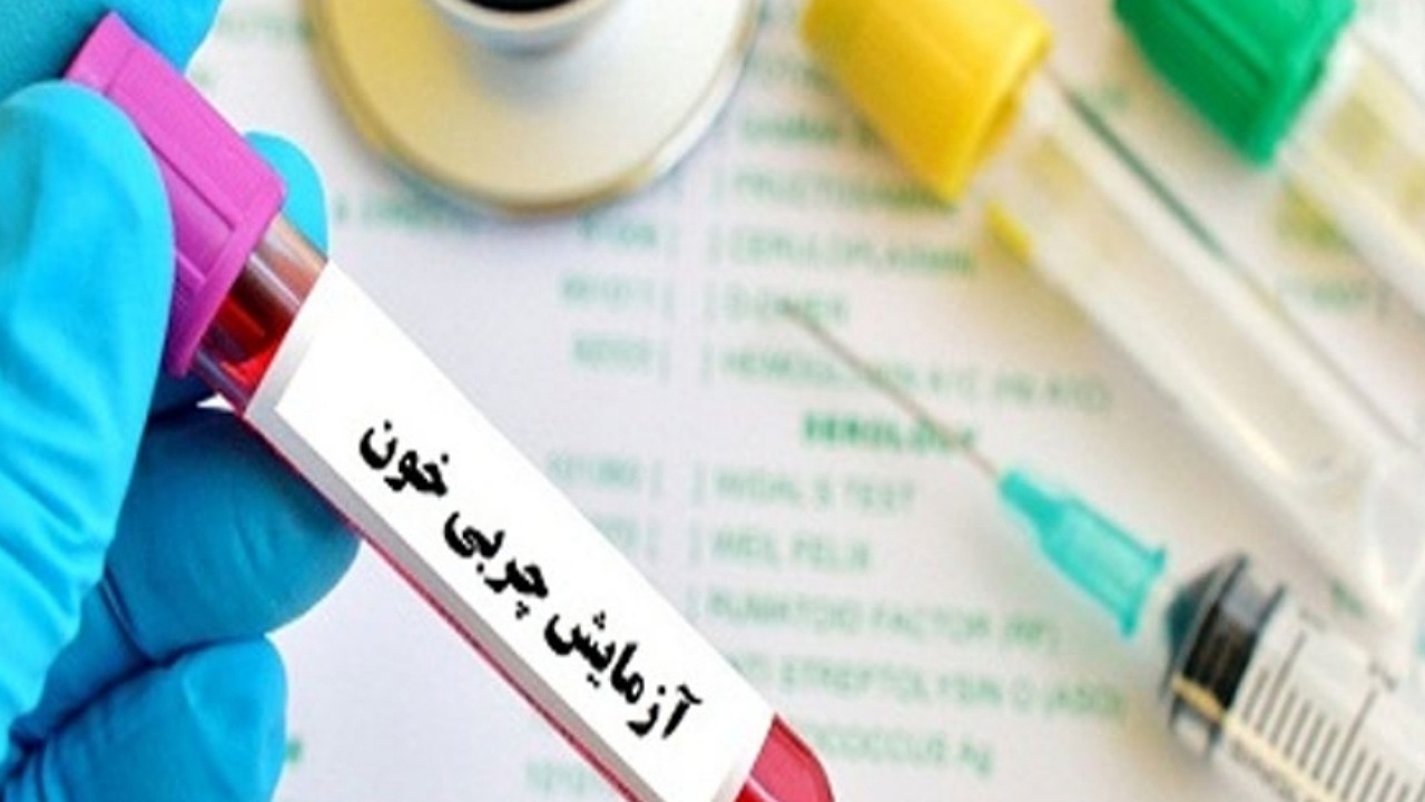 آزمایش