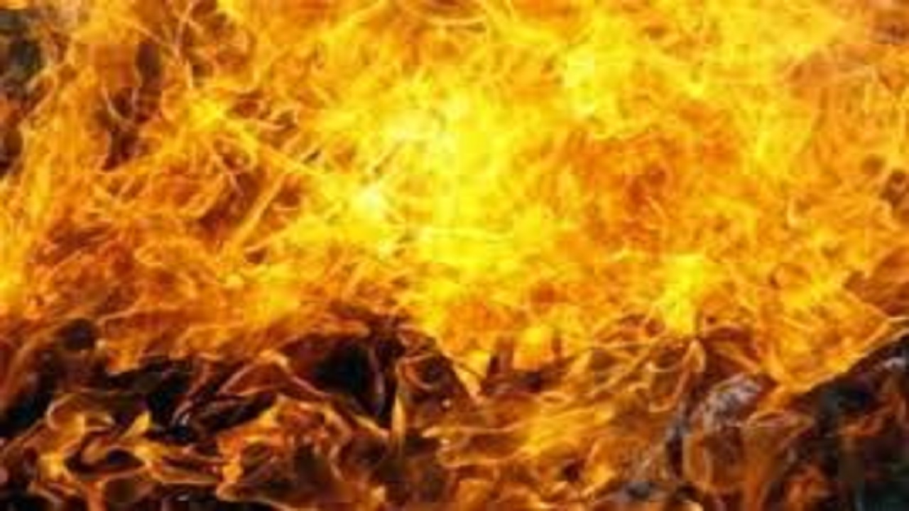 کودک نیشابوری با ۷۰درصد سوختگی از مرگ نجات یافت