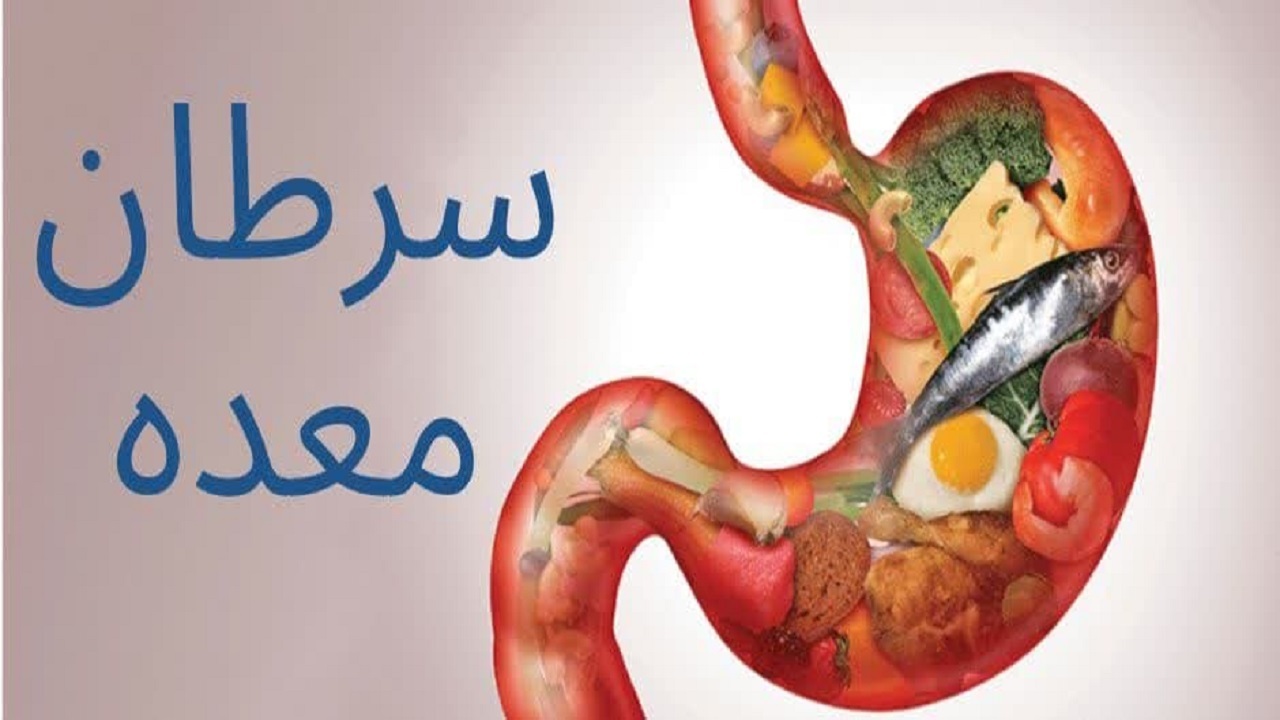 تغذیه سالم و غربالگری رمز پیشگیری از ابتلا به بیماری سرطان معده