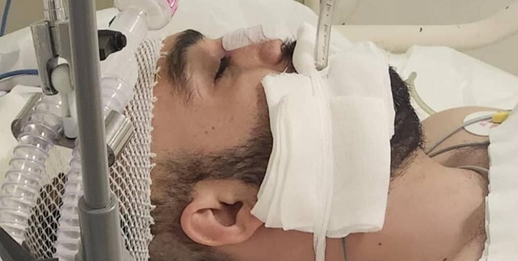 اعضای بدن فرشید لک اهدا می شود
