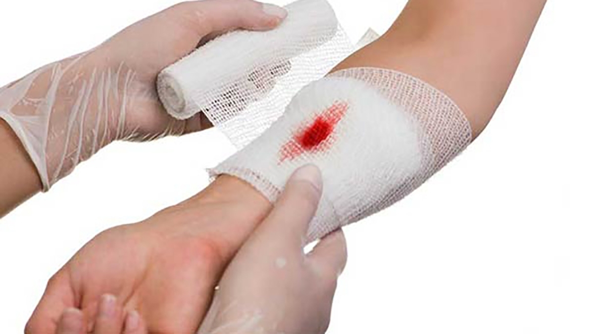 چرا بریدگی با کاغذ دردناک است ؟ + فیلم