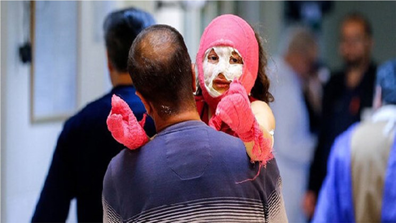 ۱ فوتی و ۹۱ مصدوم در حوادث چهارشنبه‌سوری استان فارس