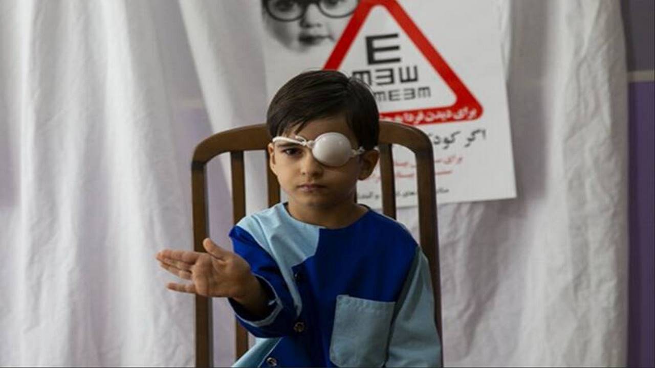 سلامت چشم ۲۳ هزار کودک ایلامی سنجش شد