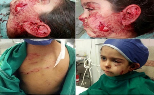 معضلی که پاچه حیات وحش را گرفته است