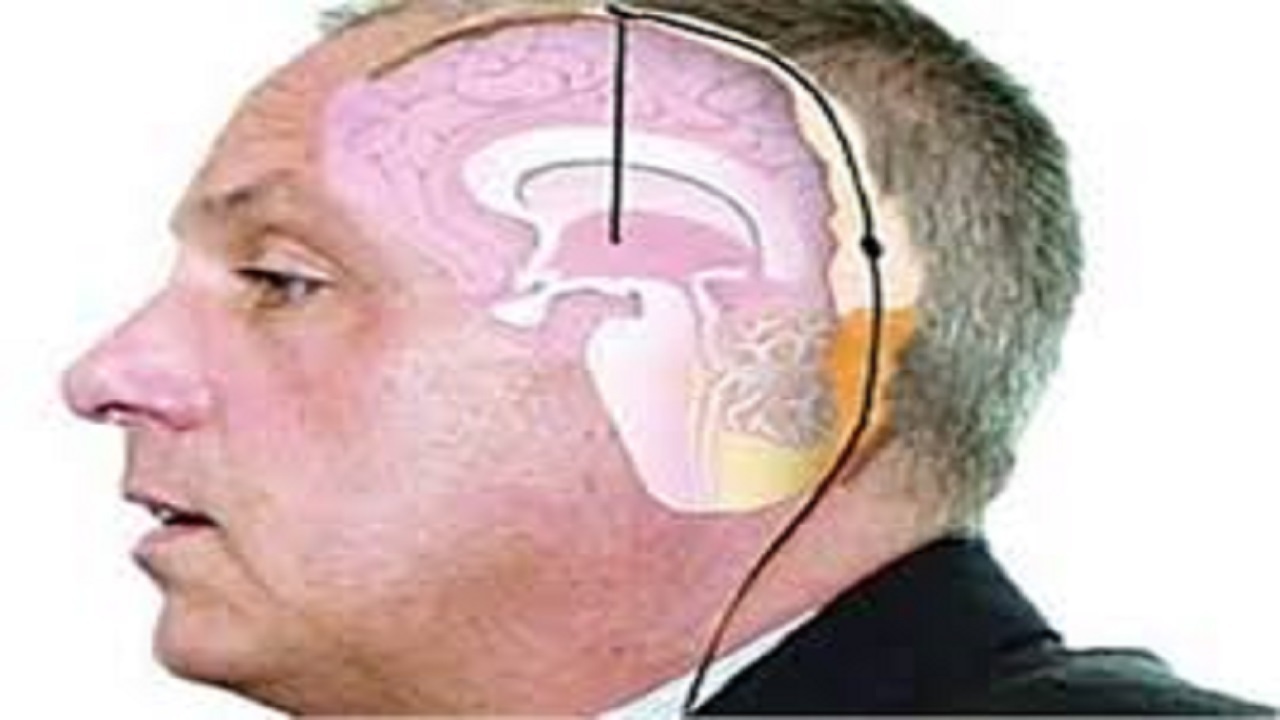 از راهکارهایی برای کنترل وزن با خوابیدن تا کشف داروی ضد دیابت و چاقی