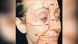 چه فرآیندی در قلب منجر به حمله قلبی می‌شود؟ + فیلم‌
