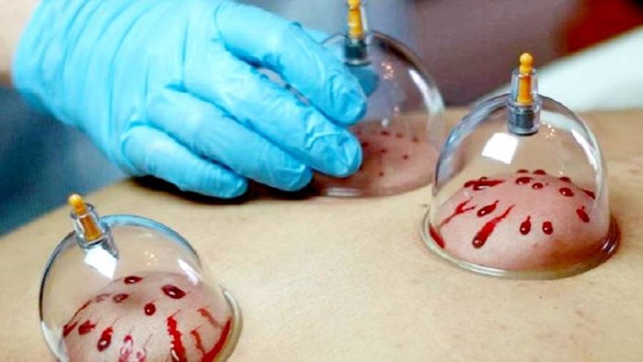 حجامت و همه چیز درباره آن؛ از سابقه تا ۸ نکته خواندنی