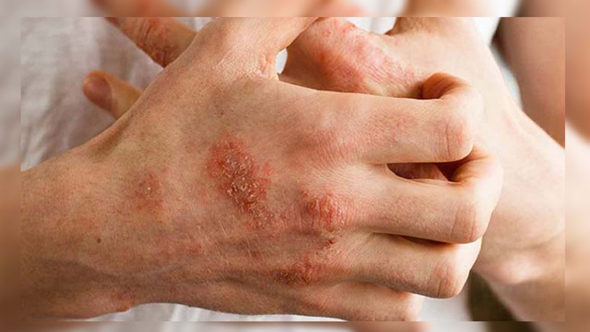 ضد تعریق خانگی بسازید ! + فیلم