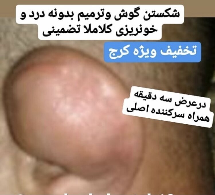 شکستن گوش ۴۵۰ هزار تومان ناقابل