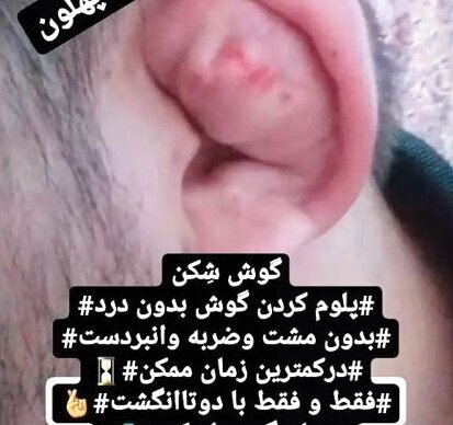 شکستن گوش ۴۵۰ هزار تومان ناقابل