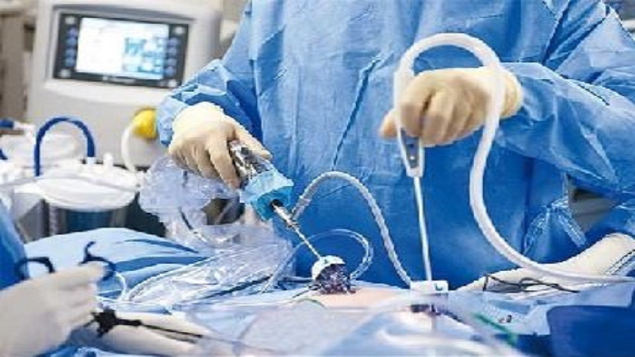 خرید دستگاه لاپاروسکوپی در کاشان
