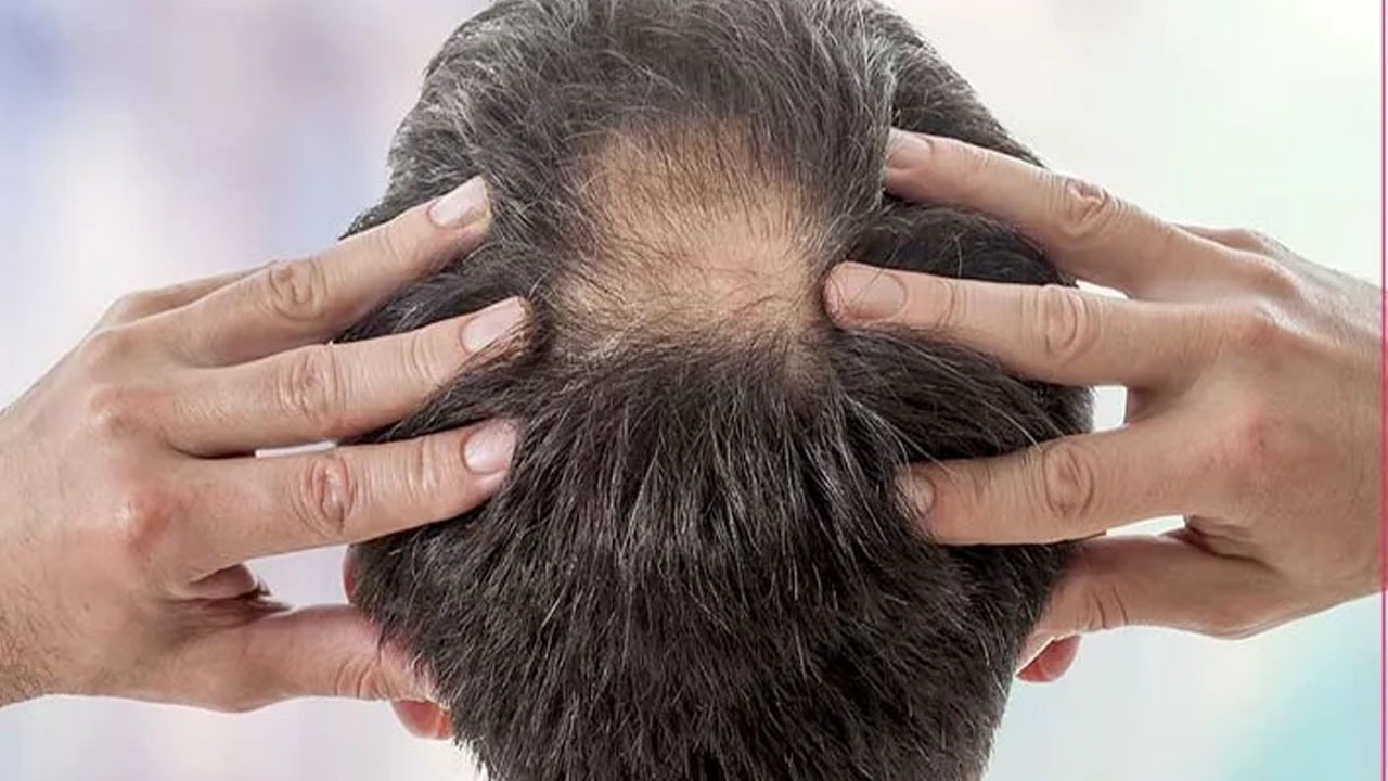 چگونه می‌توان مو‌های کم پشت را تقویت کرد + راه حل‌های موثر