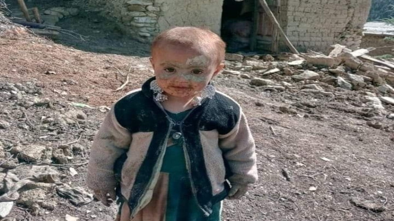 اکثر قربانیان زلزله افغانستان زنان و کودکان هستند