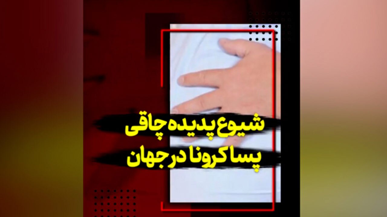 معضل چاقی مفرط در دوران پساکرونا + فیلم