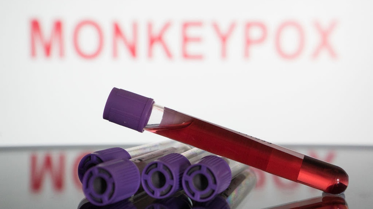 اولین مورد ابتلای یک زن به آبله میمون در انتاریوی کانادا