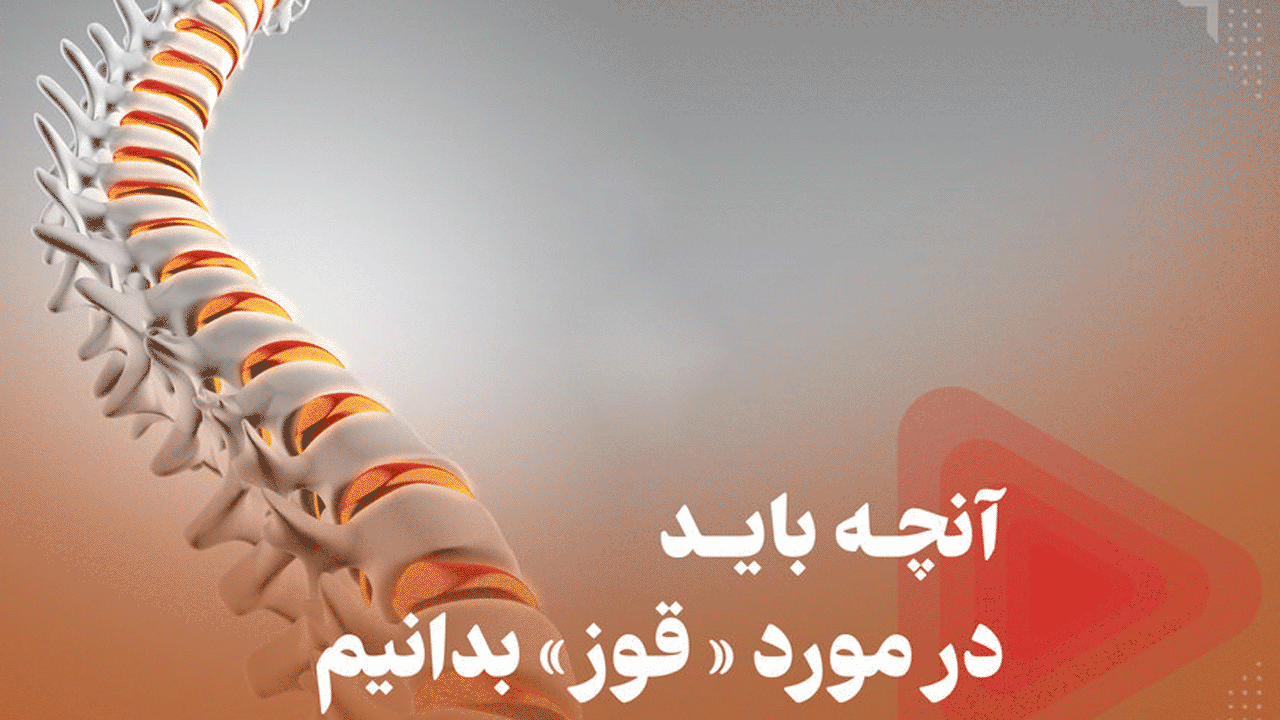 آنچه باید در مورد قوز بدانیم + فیلم