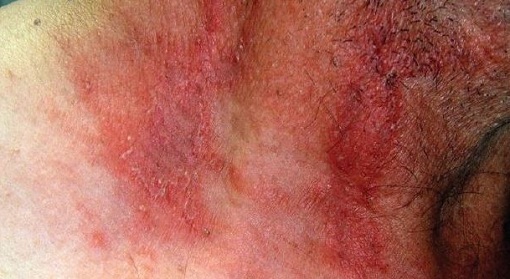 دراکولاها به انسانهای سفید پوست جذب و آسیب بیشتری به آنها میزنند / تاول سوغات دراکولای کوچک برای انسان ها دراکولاها به انسانهای سفید پوست جذب و آسیب بیشتری به آنها میزنند / تاول سوغات دراکولای کوچک برای انسان ها