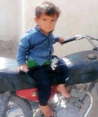 کودک عقرب زده