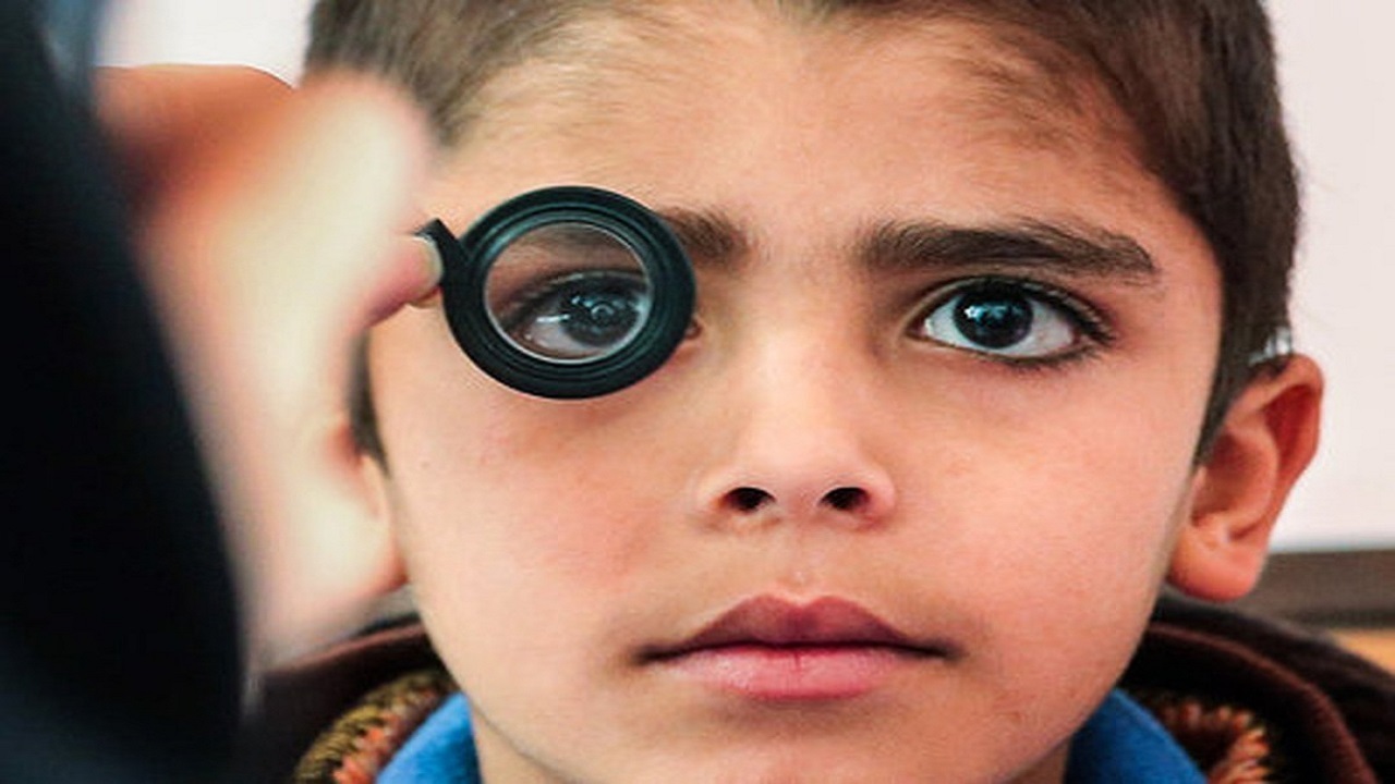 نجات ۵۰ هزار کودک از خطر معلولیت بینایی در سال ۱۴۰۰