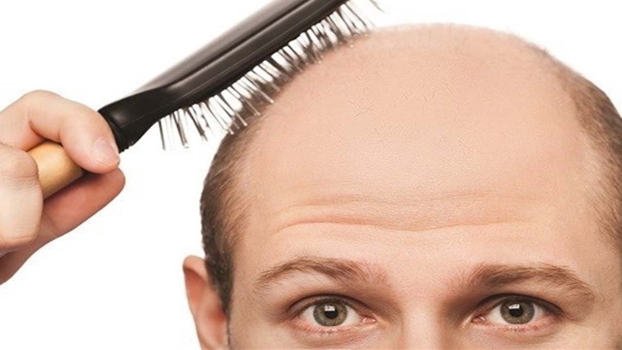 واقعیت‌هایی در مورد ریزش مو؛ ۸ باور اشتباه که باید فراموش کنید