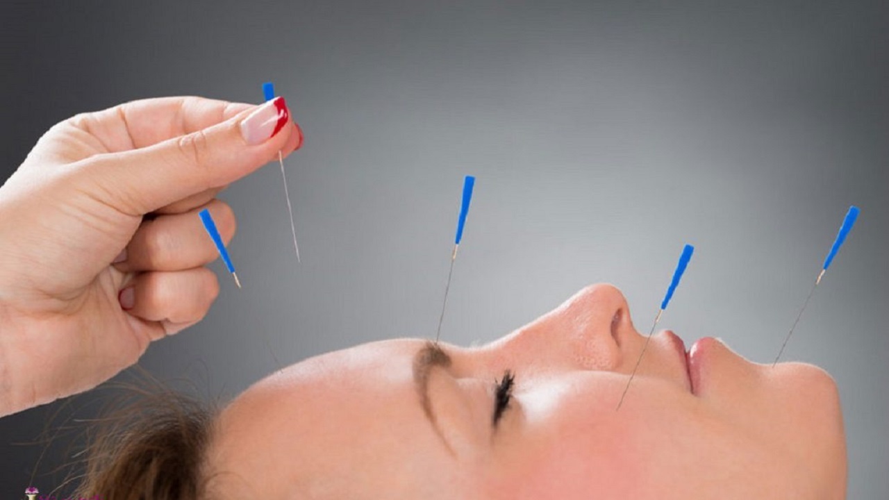 طب سوزنی روی صورت زن چینی + فیلم