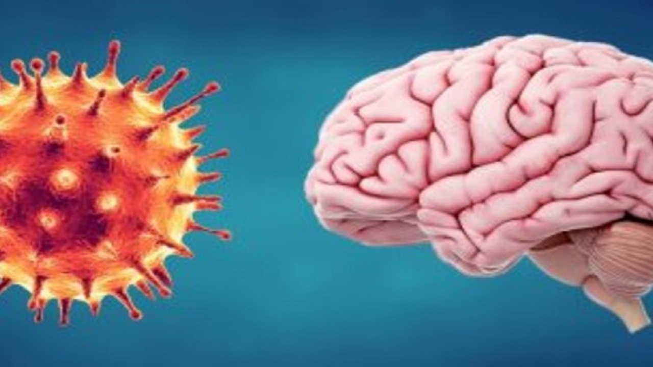 جراحی مغز مبتلایان به پارکینسون و صرع به کمک کامپیوتر