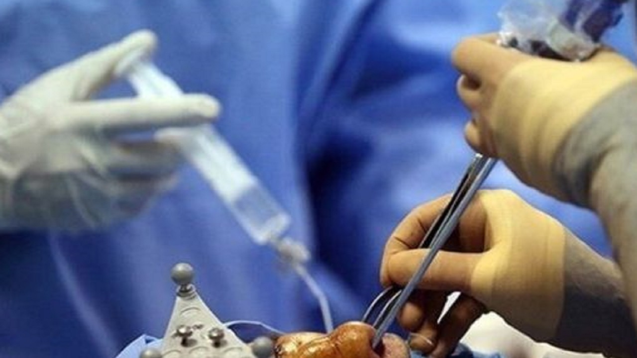 انجام جراحی زیبایی زنان در مغازه و دستگیری فرد متخلف در مشهد