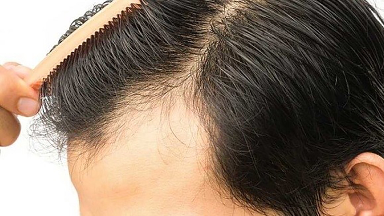 تشخیص مزاج از روی نوع مو + فیلم