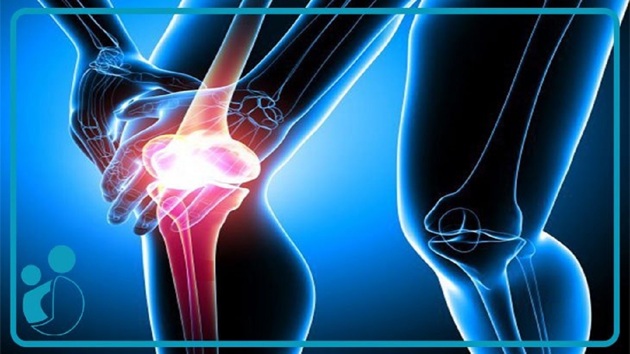 مهمترین عوامل ایجاد کننده آرتروز چیست؟ + فیلم
