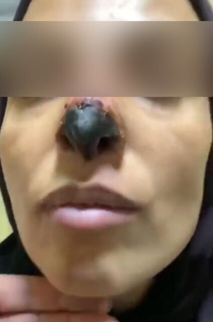 جراحی ناموفق جراحی ناموفق