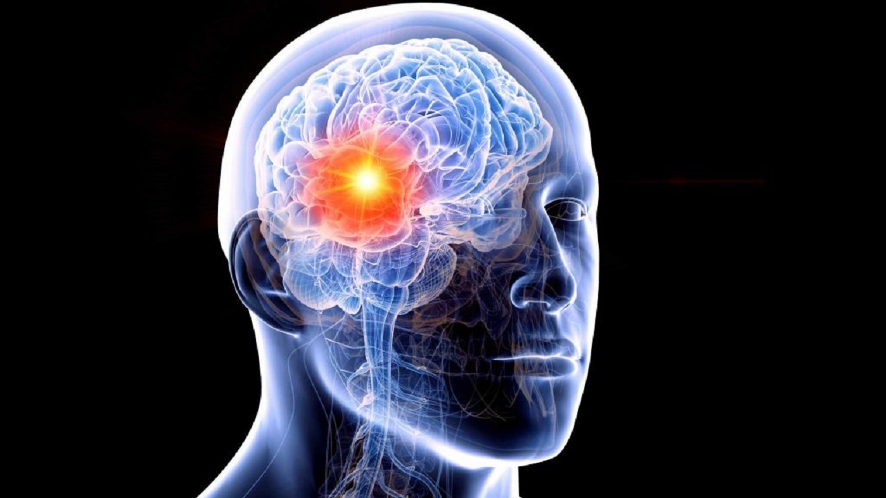 بررسی تومورهای سرطانی با استفاده از  فناوری یادگیری عمیق