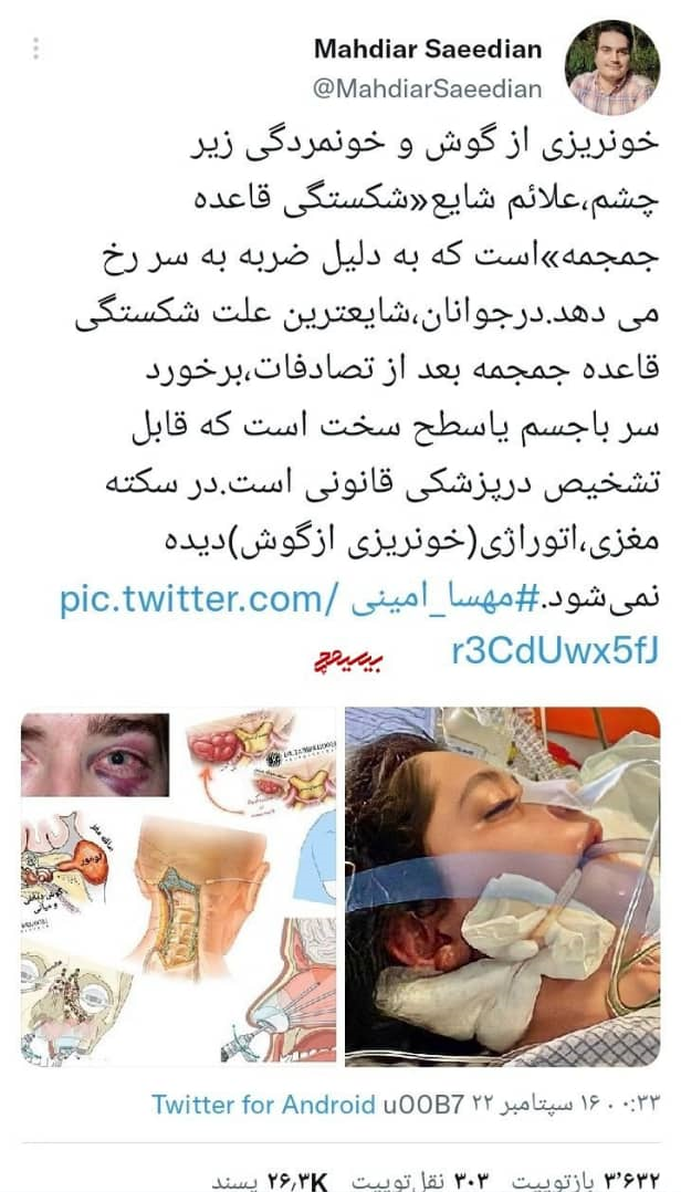 طومار دروغهای ضدانقلاب تنها در ۴۸ساعت