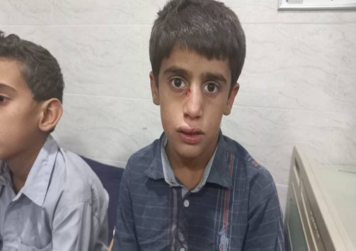 &zwnj;واژگونی خودروی ووشوکاران بشاگردی