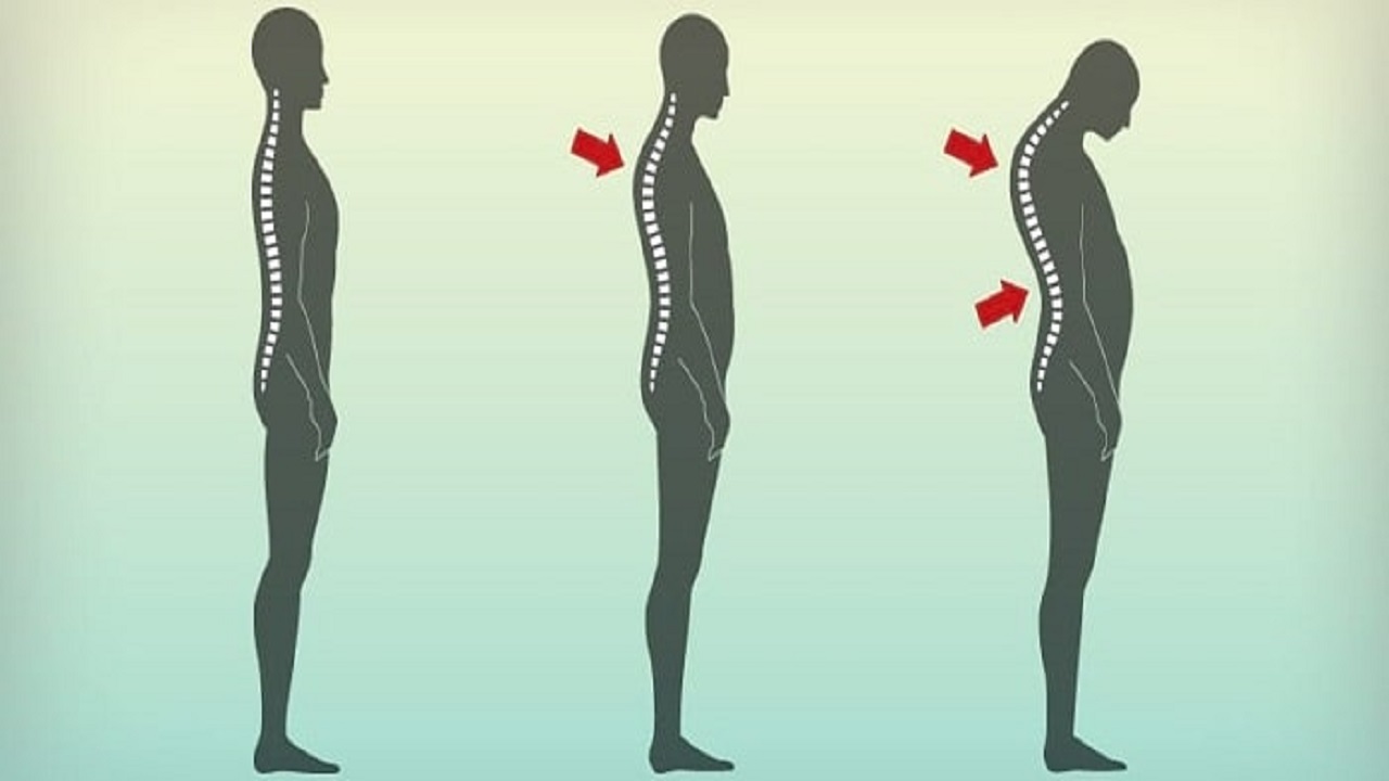 آموزش حرکت اصلاحی برای جلوگیری از ایجاد قوز + فیلم