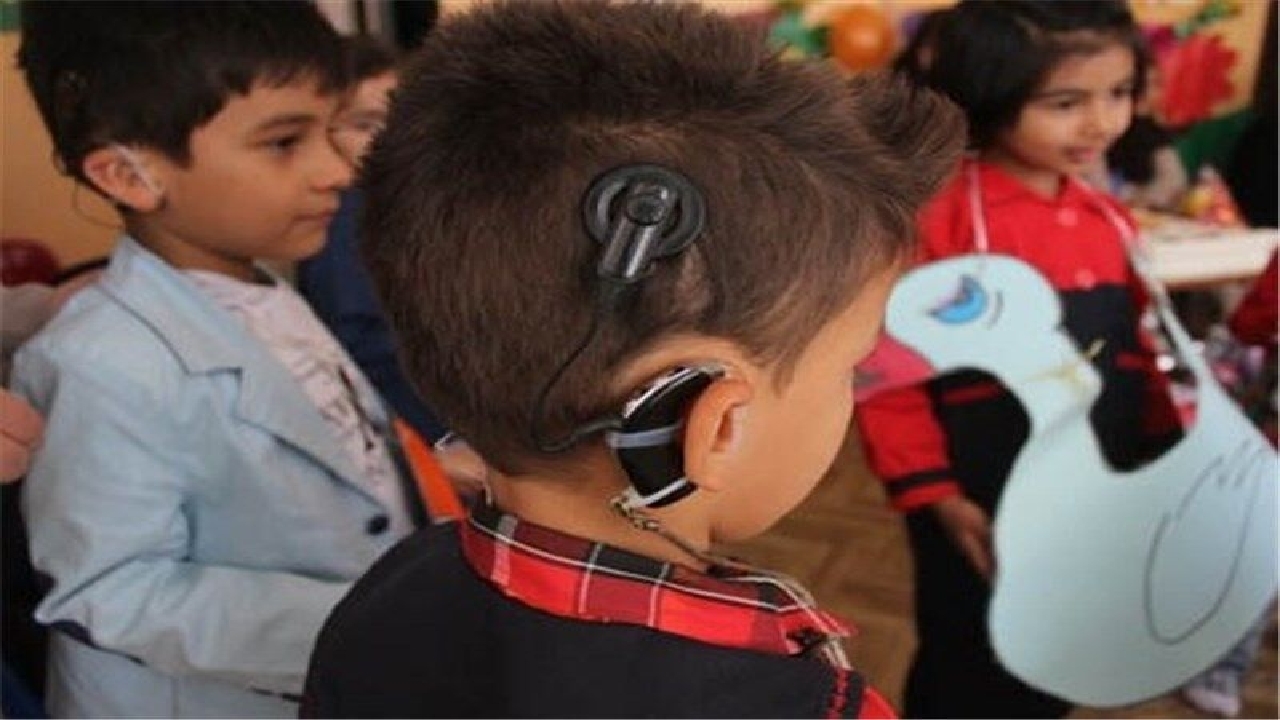 عمل کاشت رایگان حلزون برای ناشنوایان در خراسان رضوی