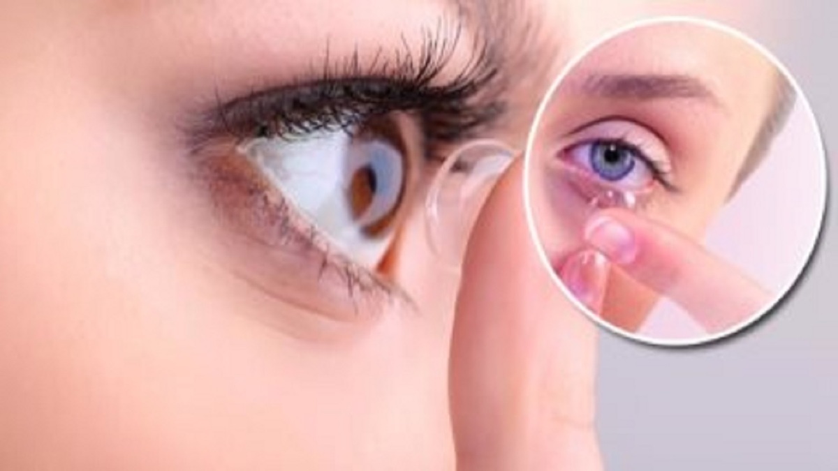 باشگاه خبرنگاران -فراموشی عجیب یک پیرزن آمریکایی در مورد لنزهای تماسی خود