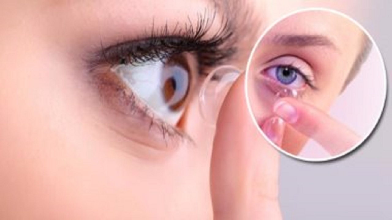 فراموشی عجیب یک پیرزن آمریکایی در مورد لنزهای تماسی خود
