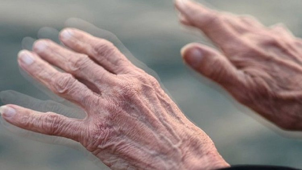 ساخت دستگاه کنترل از راه دور پارکینسون