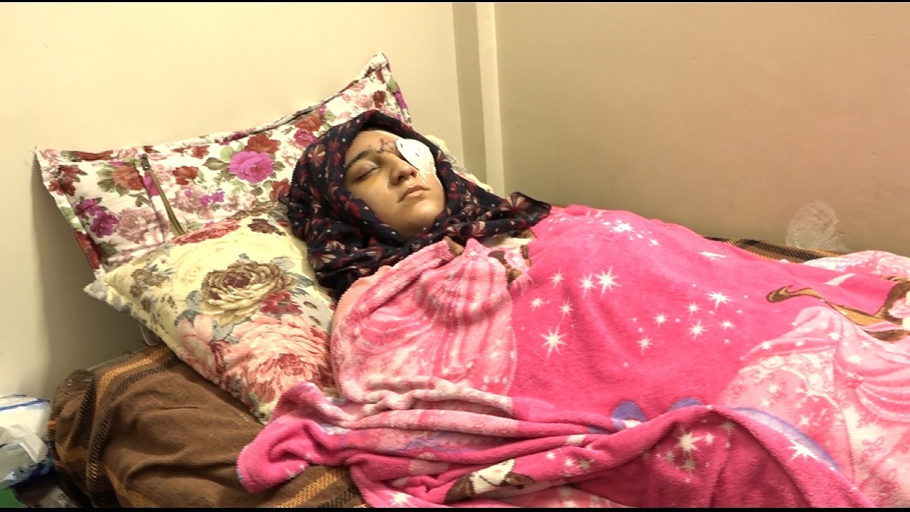 دختر همدانی یک چشم خود را در اثر اغتشاشات اخیر از دست داد