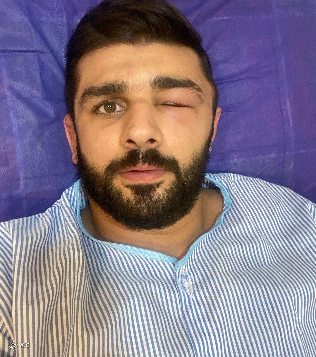بستری شدن کشتی گیر تیم ملی + تصویر