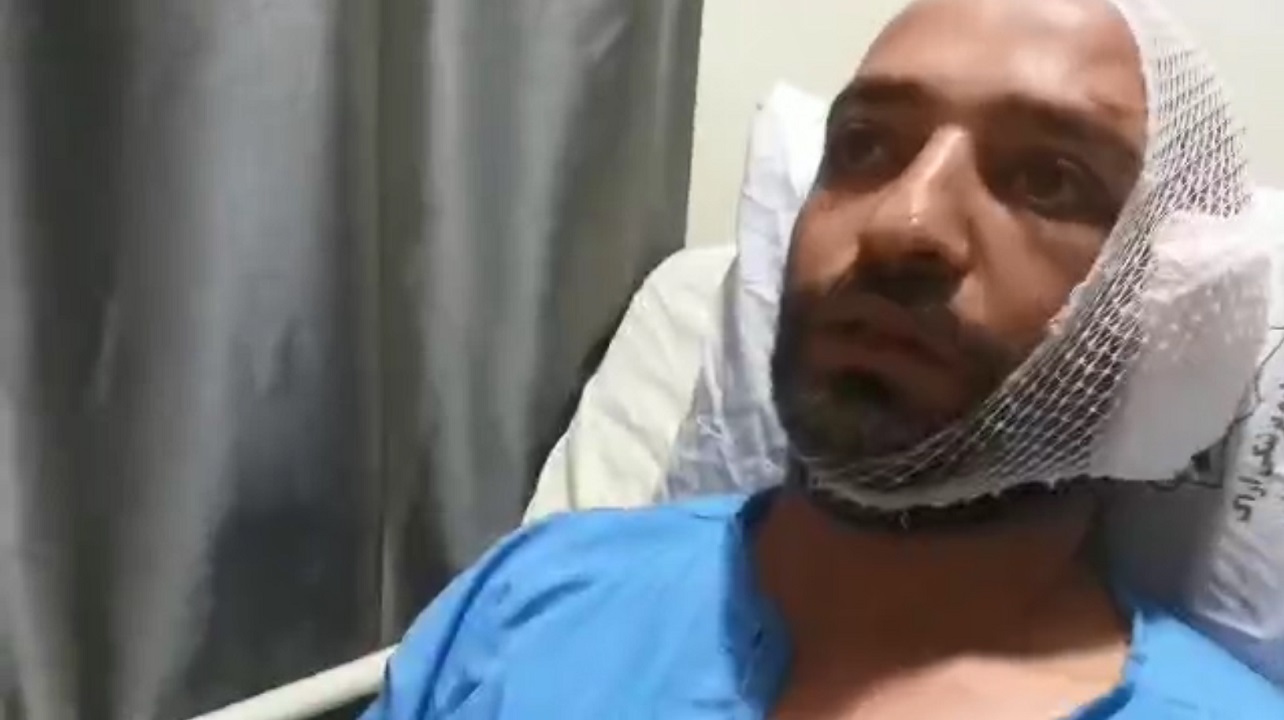 داریوش عبدالعلیان زنده شد + فیلم