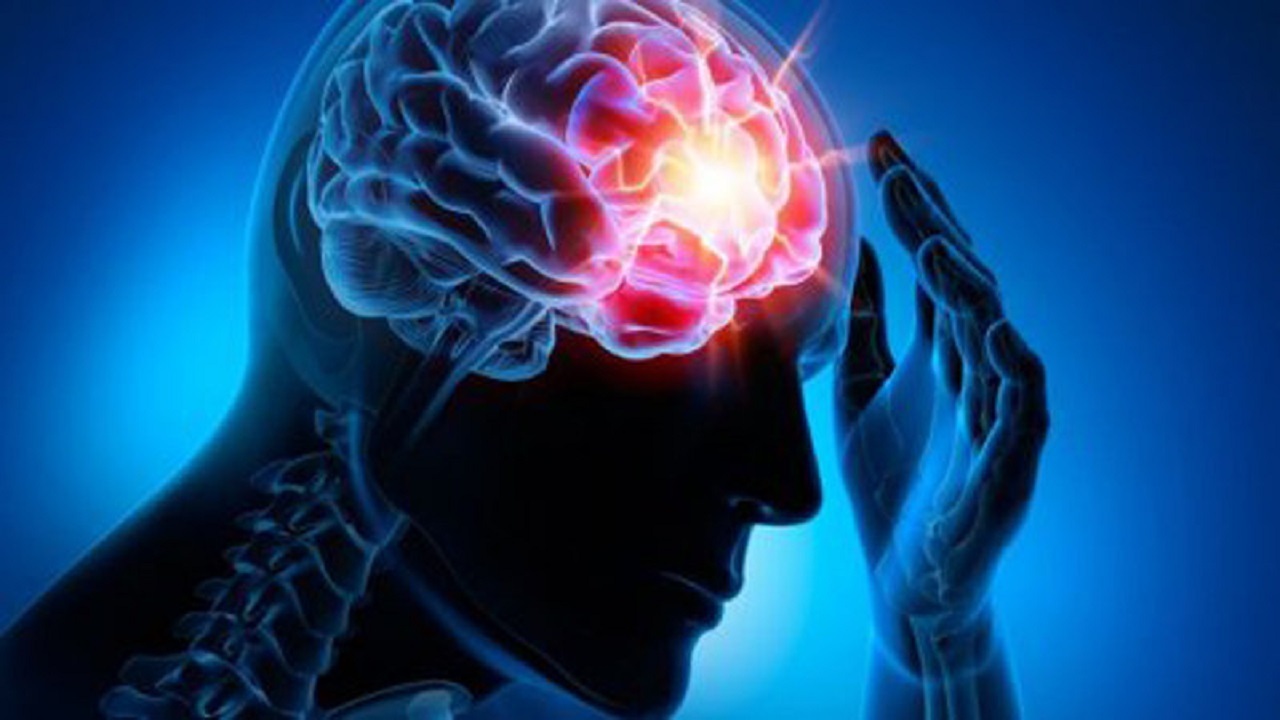 چگونه سکته مغزی را تشخیص دهیم؟
