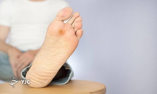شیرین خاموش، اما تلخ و خطرناک/ وجود ۲۰۰ هزار بیمار دیابتی در گلستان