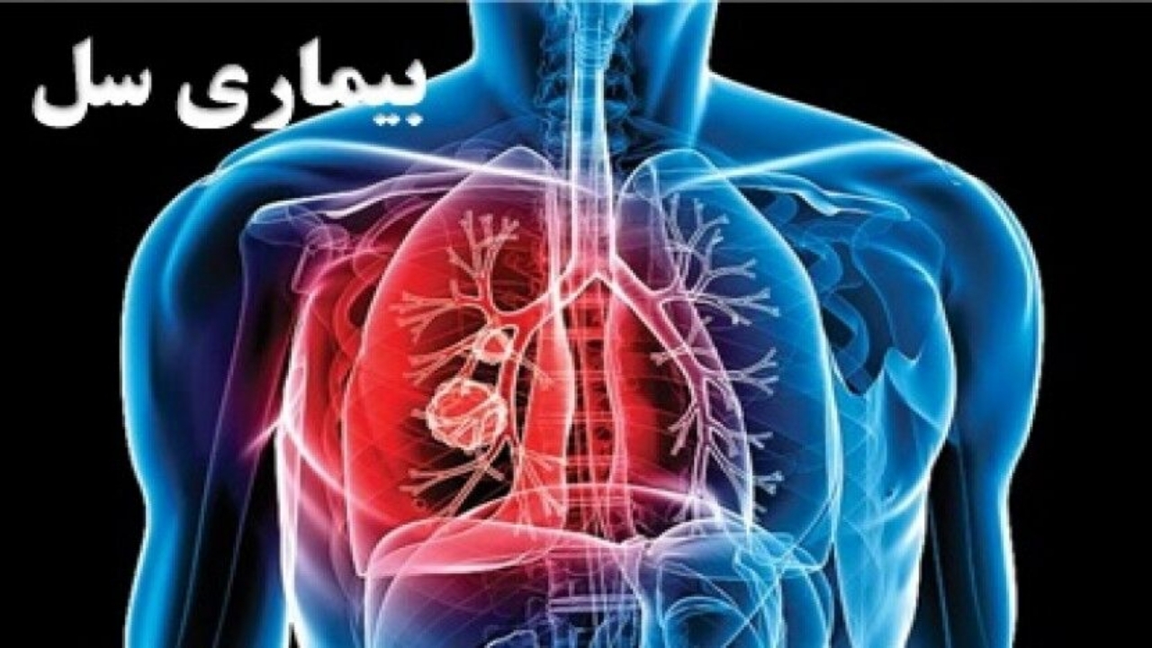 به ازای حدود هر صد هزار نفر، ۱۱/۳ نفر در خراسان رضوی مبتلا به سل هستند