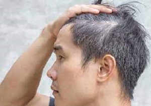 علت سفید شدن رنگ موها چیست؟