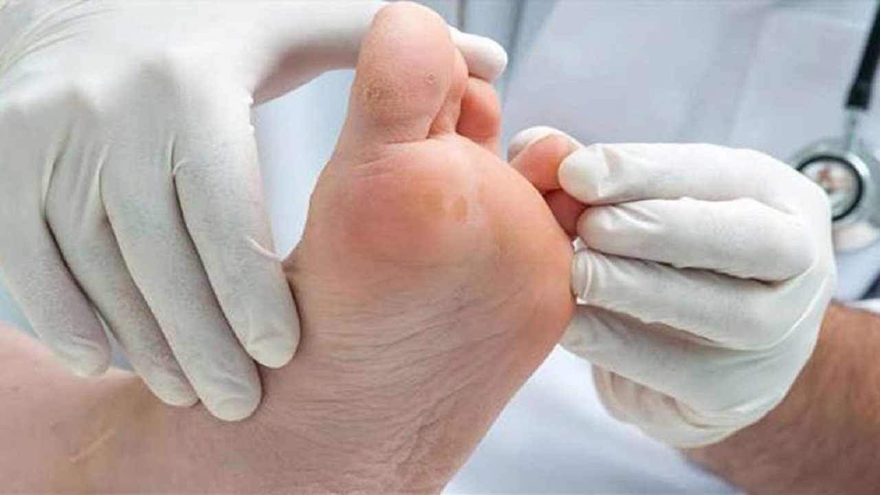 راه اندازی درمانگاه زخم پای دیابتی و سلول‌های بنیادی و پزشکی بازساختی