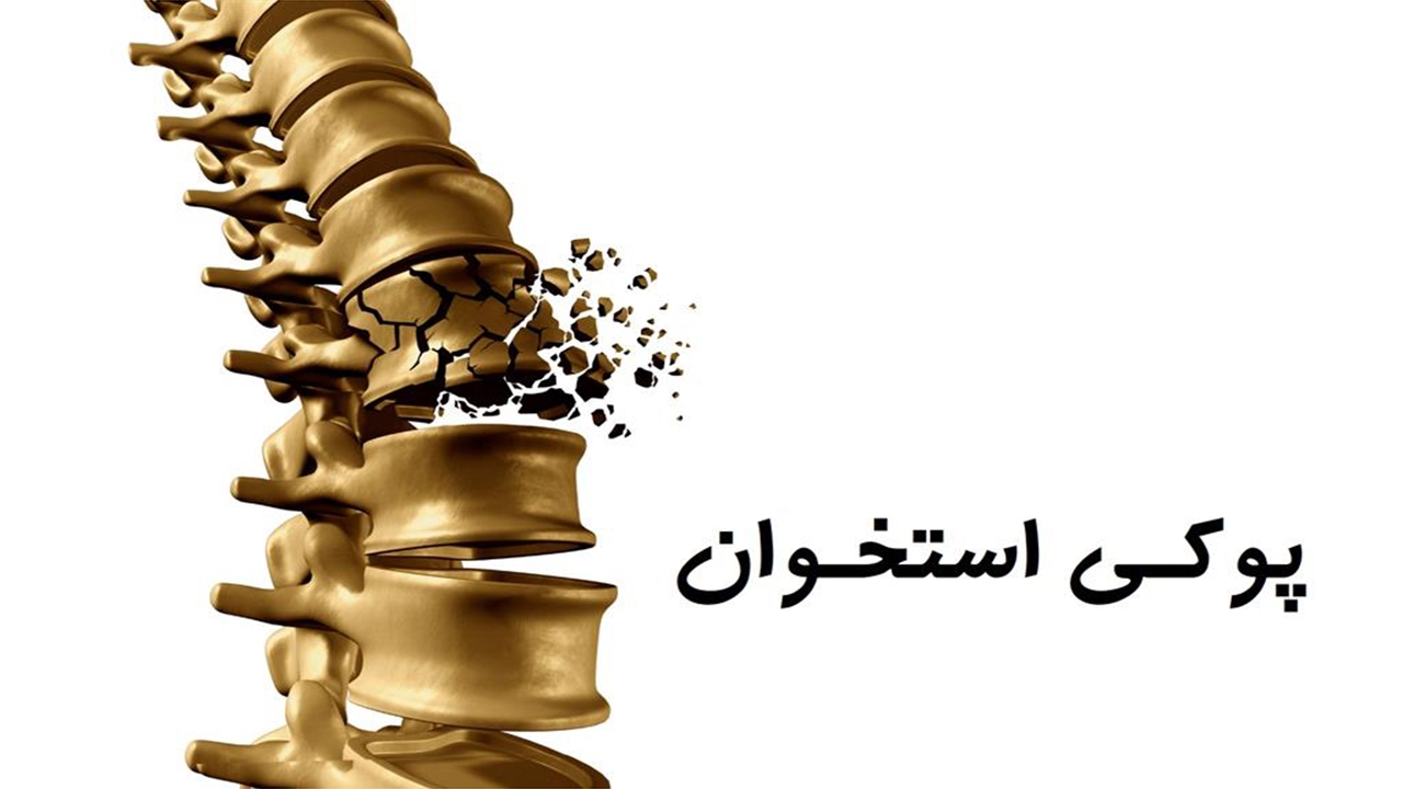 پیشگیری از پوکی استخوان با دریافت کافی ویتامین D