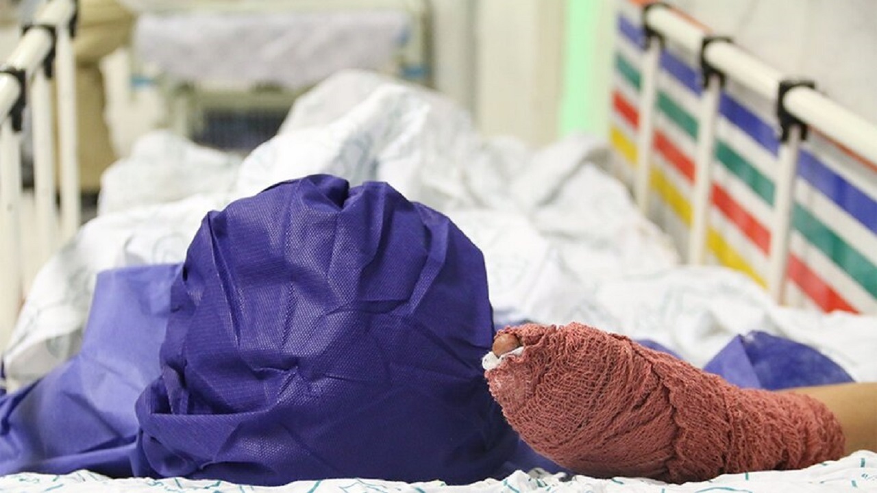 قطع دست جوان فراهانی به دلیل انفجار مواد محترقه